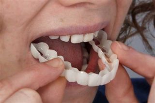 آشنایی با پروتز دندان