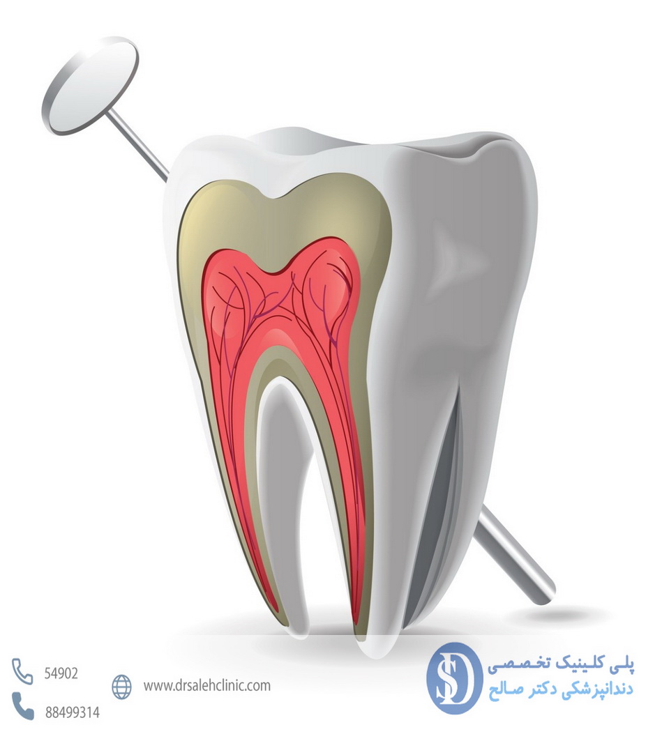 درمان ریشه دندان در دندانپزشکی فاطمی 5
