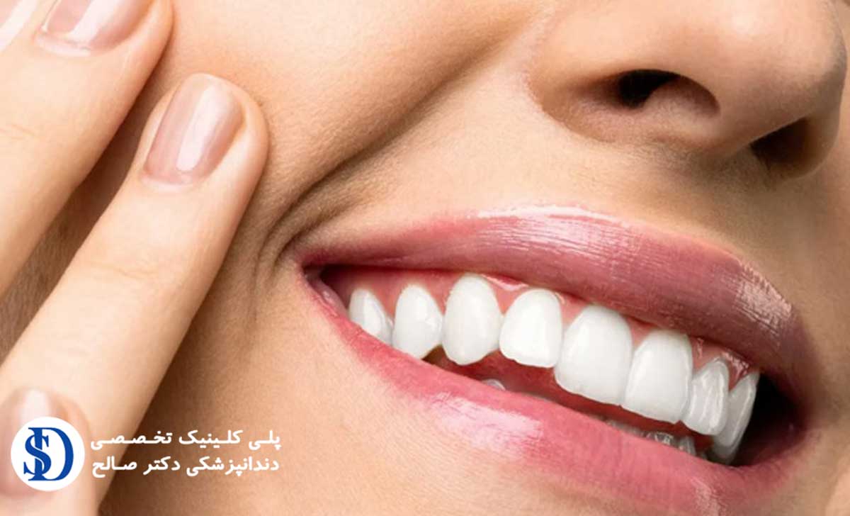 دندانپزشکی فاطمی اقساطی-تقویت مینای دندان