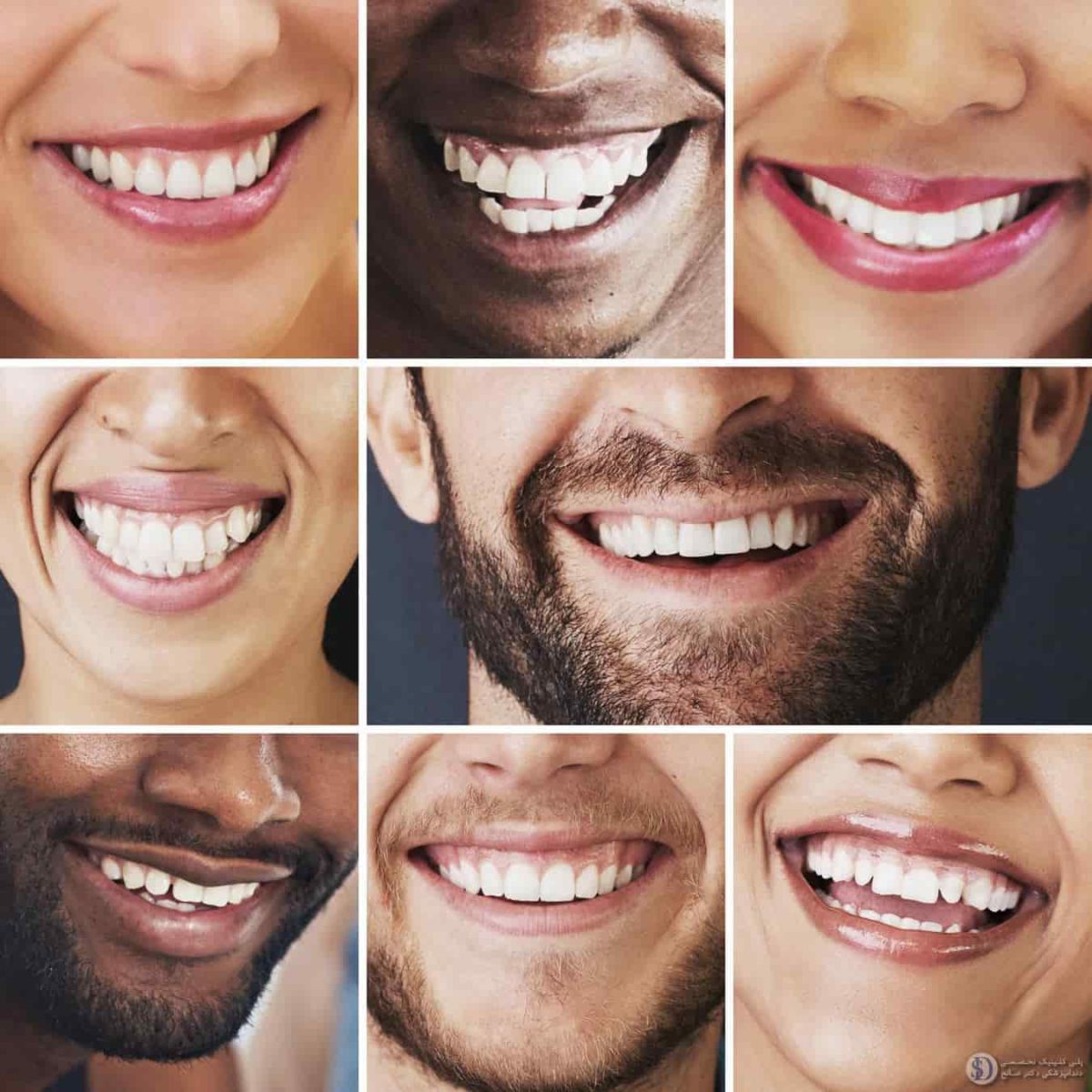 برخی از افراد که می‌توانند از مزایای اصلاح طرح لبخند بهره‌مند شوند