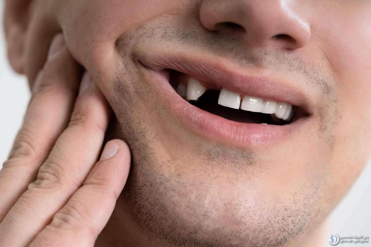 خطرات آجیل برای دندان