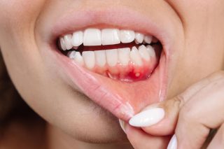 نقش مشکلات دندانی در وزوز گوش:بیماری لثه